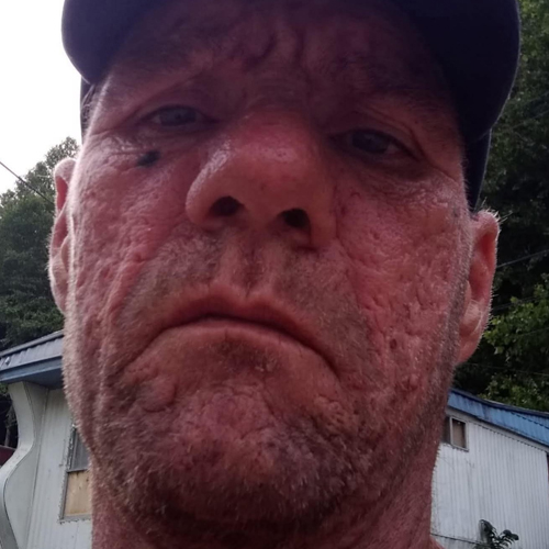 Albert Maynard Obituary